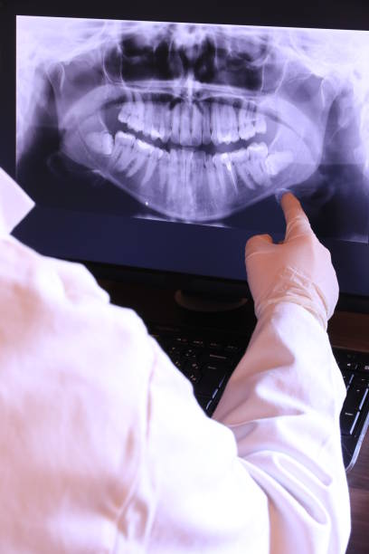 Best Emergency Gum Treatment in Weston, OH